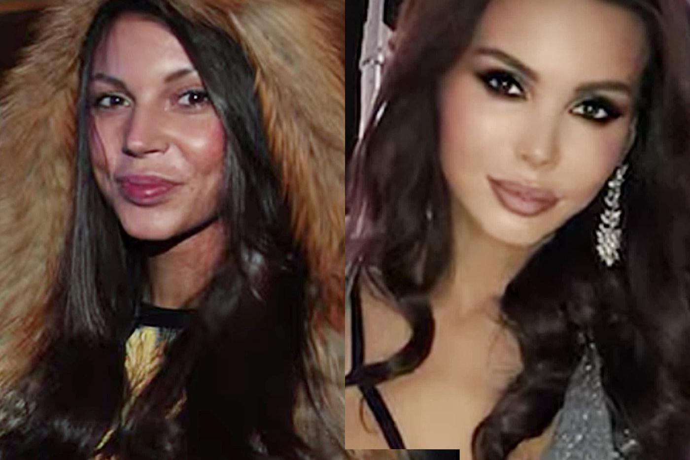 Оксана самойлова фото до и после пластики и без макияжа