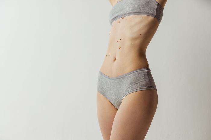 На вашем теле много родинок или появились новые? Самое время присмотреться к ним повнимательнее