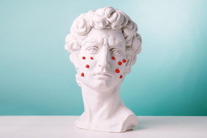 Беспокоят следы постакне? Есть косметологические способы их убрать