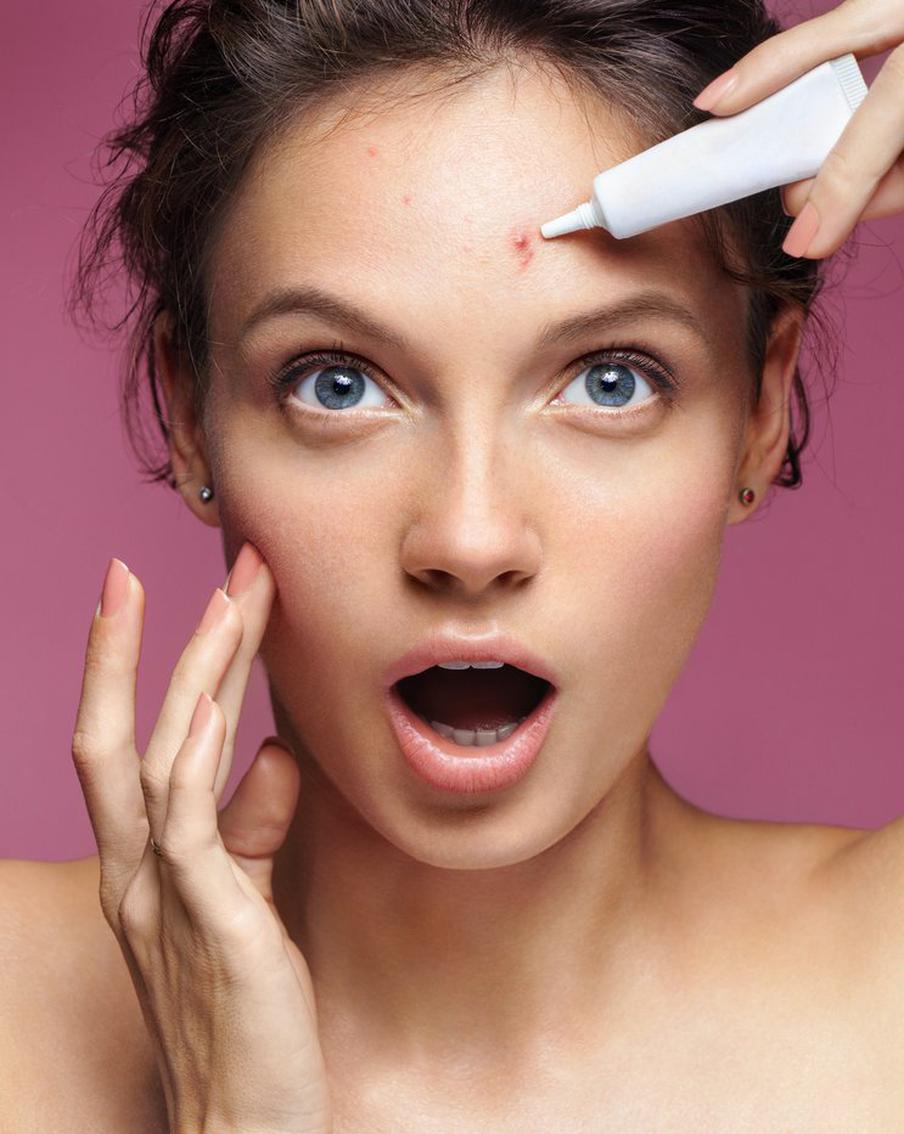 Что можно и что нельзя делать при акне. Стратегия работы с проблемной кожей