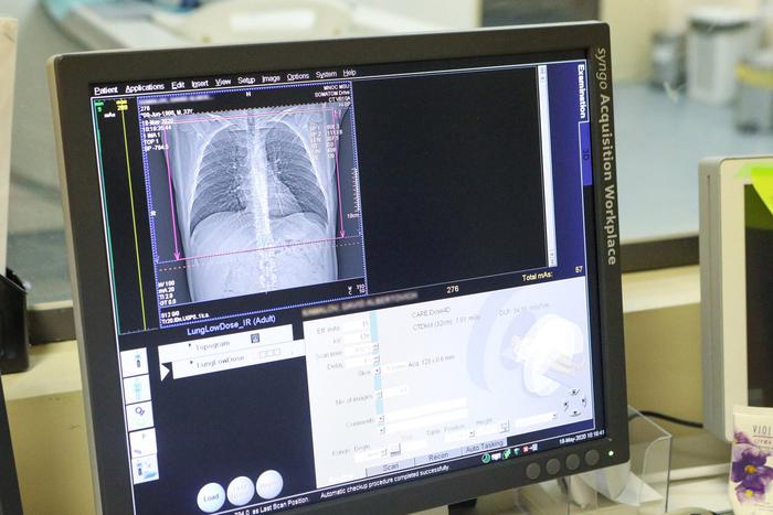 Цифровые сервисы облегчают и ускоряют работу врачей. Выяснили, как нейросети помогают анализировать данные пациентов