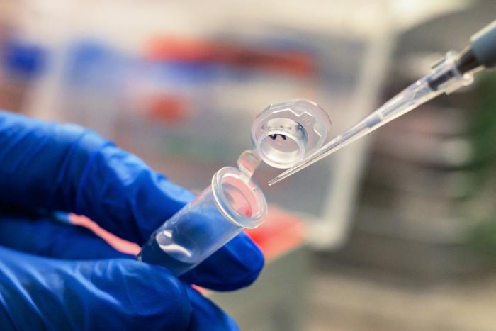 В России выявлен первый случай оспы обезьян. Что об этом известно и чего ждать дальше