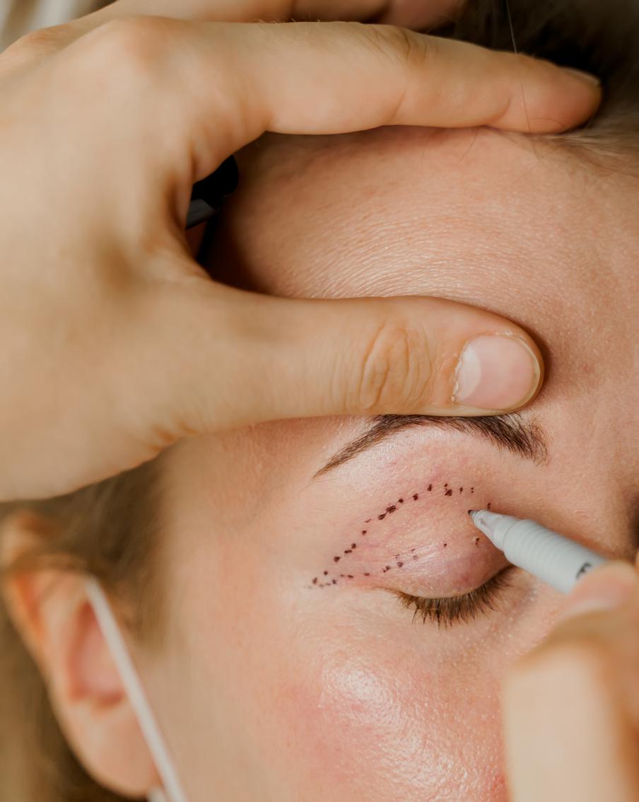 Пластические операции – услуга довольно популярная. Но после неё важно грамотно восстановиться