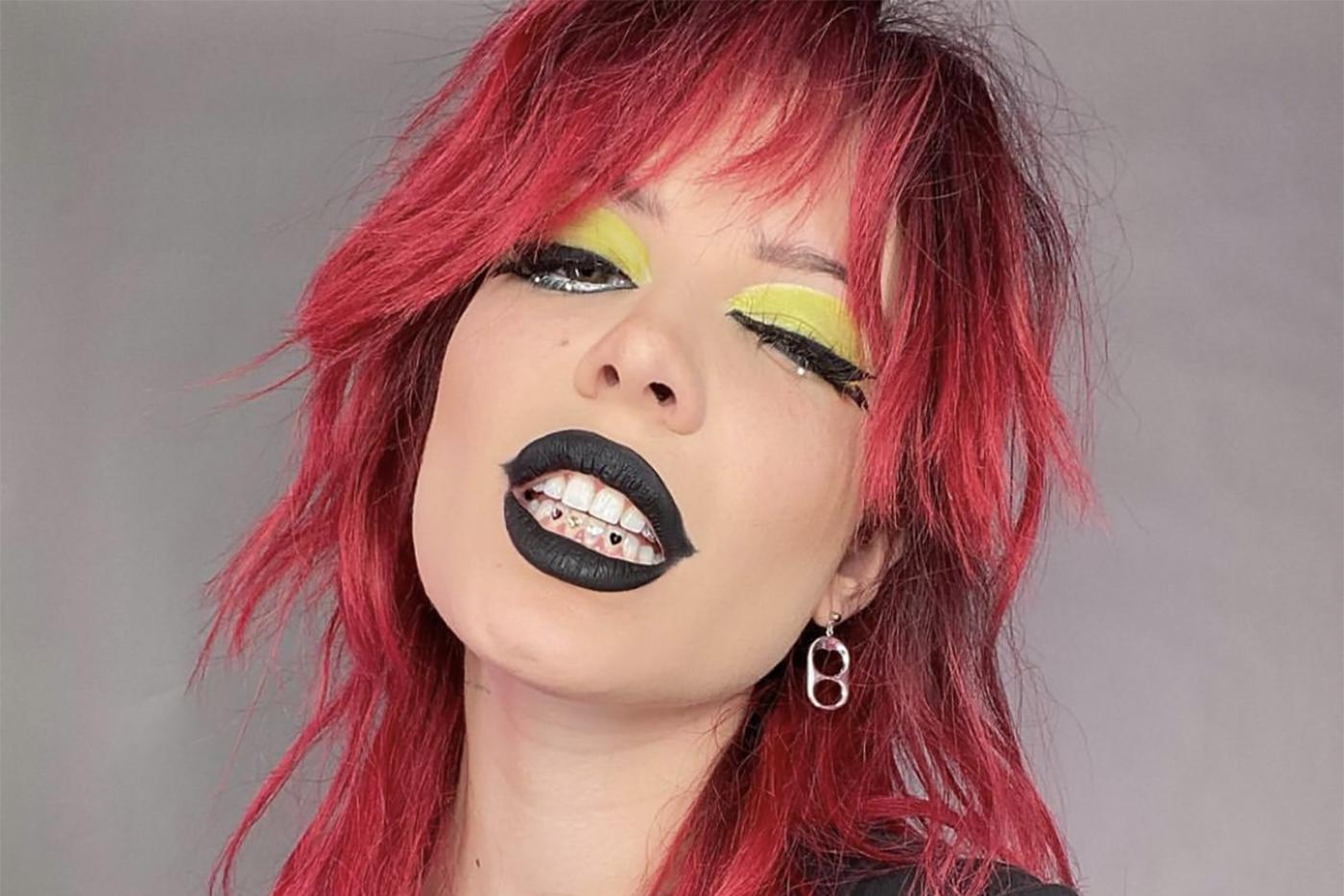 Улыбка из нулевых: что такое скайсы и как их делают