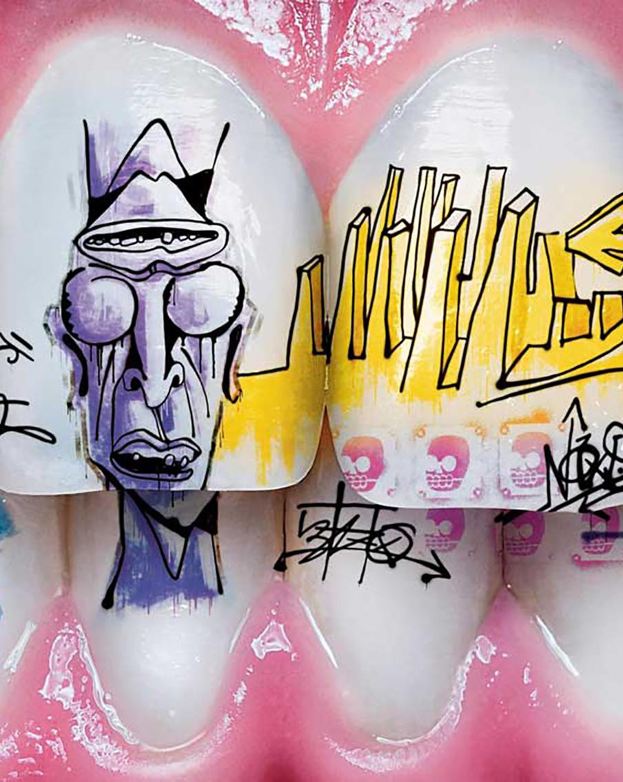 Искусство на вашей улыбке: что такое тату на зубах и как оно делается