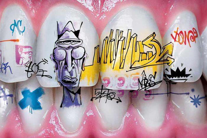 Искусство на вашей улыбке: что такое тату на зубах и как оно делается