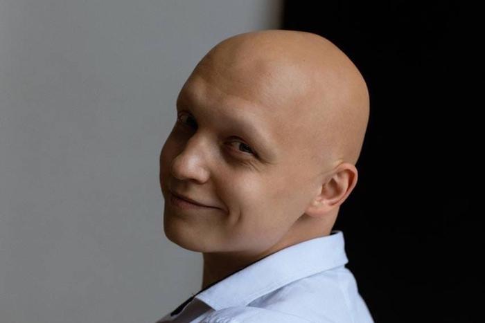 В стиле Нефертити: тверичанин создал чат для поддержки людей с облысением