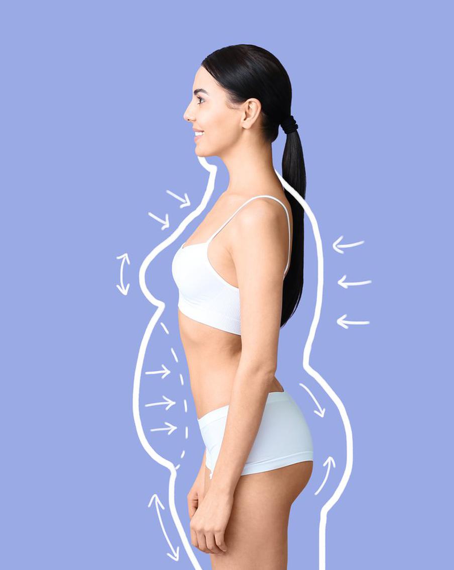 После похудения вас ждёт ещё один этап – избавление от лишней кожи