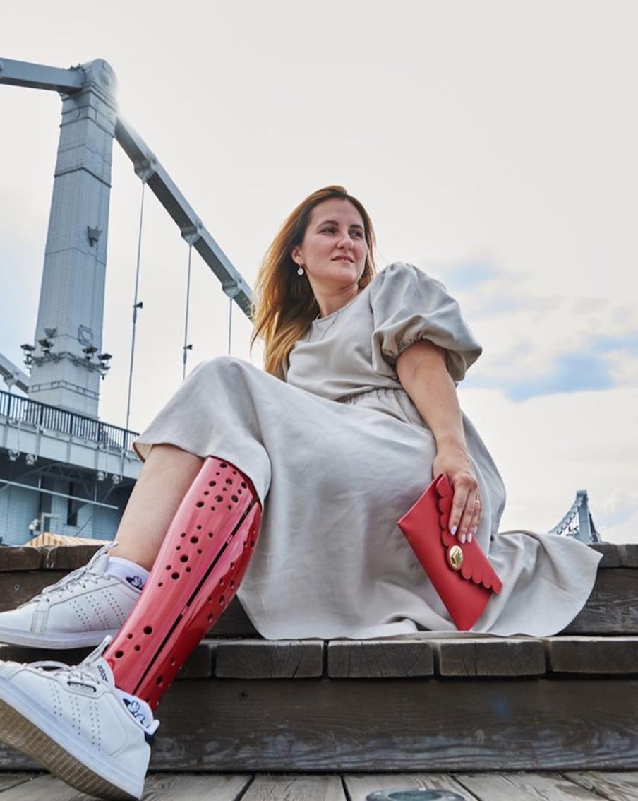 "Открытие, что могу в протезе выглядеть так модно и круто!" – москвич получил в подарок дизайнерскую накладку для протеза