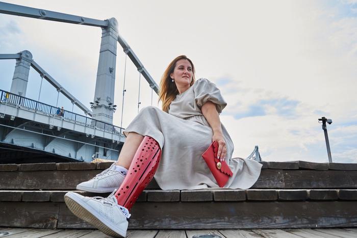 "Открытие, что могу в протезе выглядеть так модно и круто!" – москвич получил в подарок дизайнерскую накладку для протеза