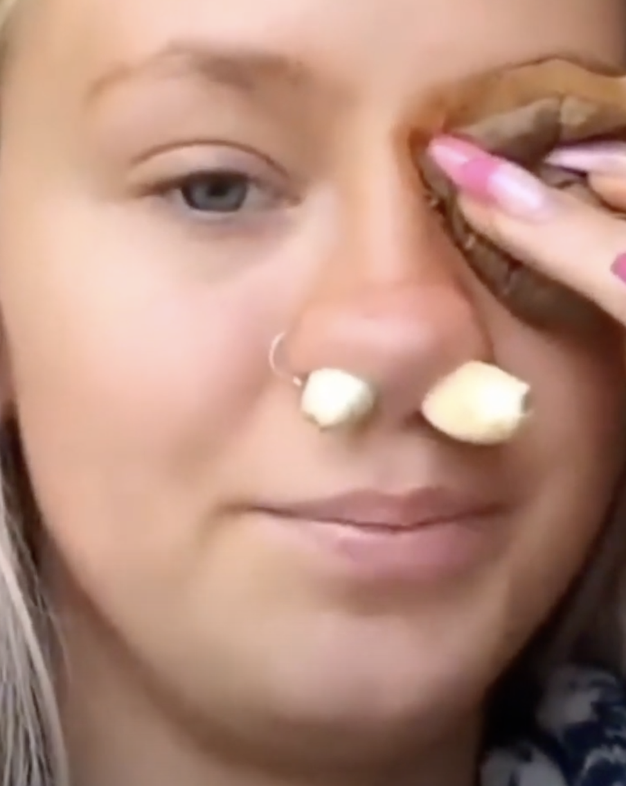 Чеснок в нос от насморка и лечение ангины авиационным керосином. Самые нелепые медицинские советы, которые популярны в соцсетях