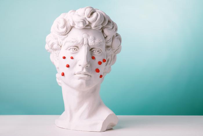 Не оставлять на самотёк: врач-дерматокосметолог рассказала, что нужно учитывать при наличии акне