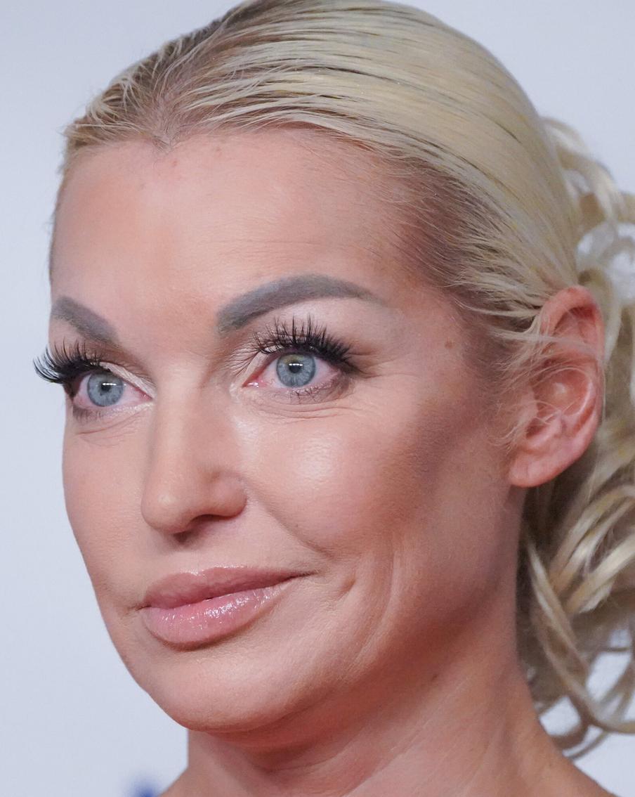 Волочкова получила травму: во время выступления повредила ногу