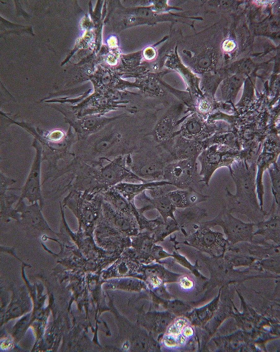 Учёные научились контролировать поведение бактерий при помощи света