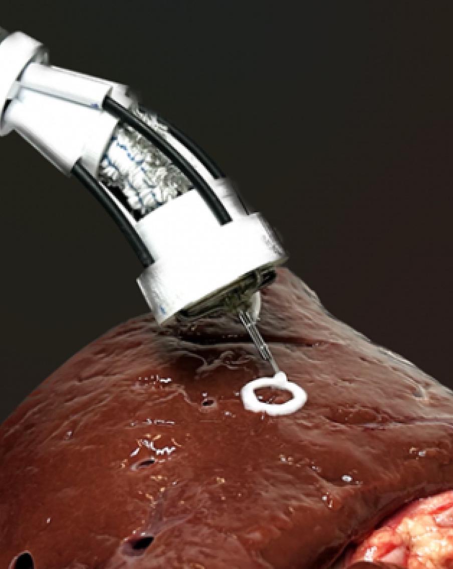 Новый робот поможет врачам, поскольку сделает операции менее рискованными