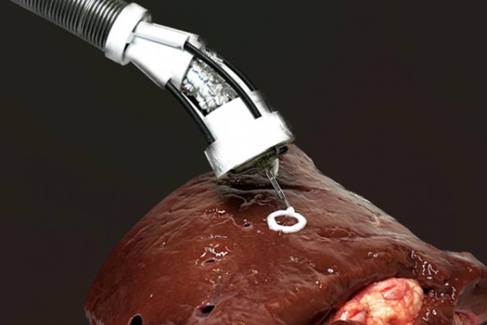 Новый робот поможет врачам, поскольку сделает операции менее рискованными