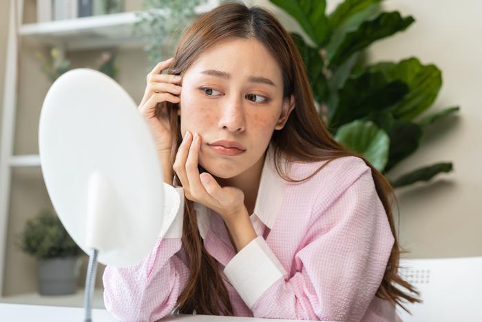 Пигментные пятна не приговор. Как от них избавиться, разбираемся вместе с экспертом