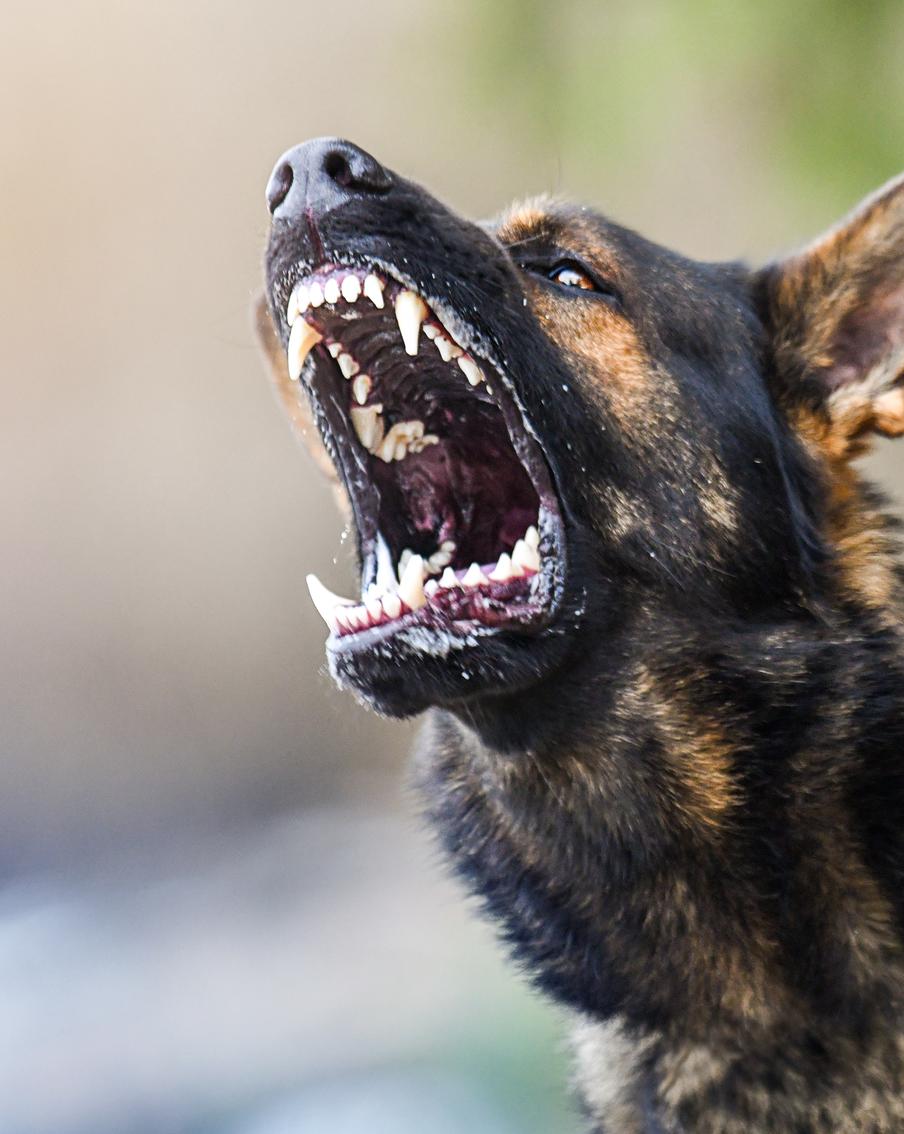 На Алтае бездомная собака чуть не покалечила девочку