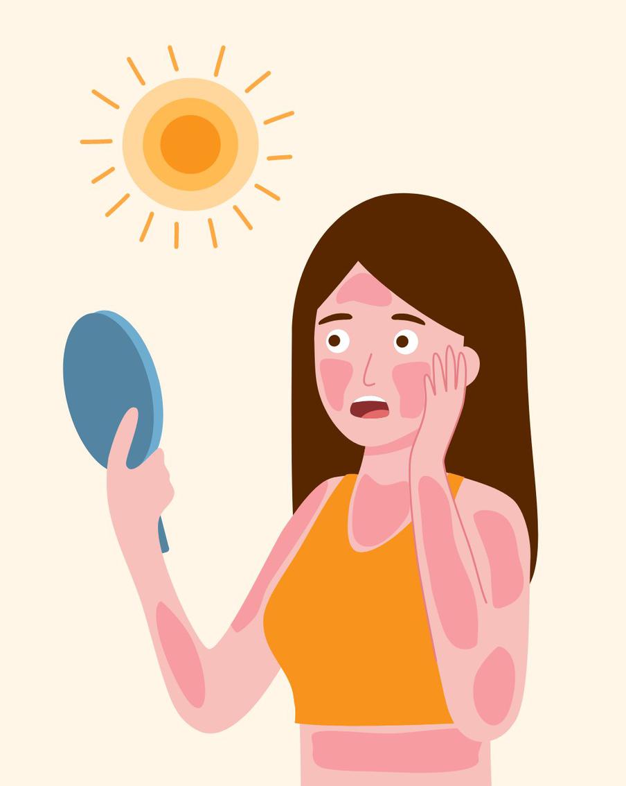 При солнечном ожоге ни в коем случае не обрабатывайте зону маслом, льдом или спиртовыми составами