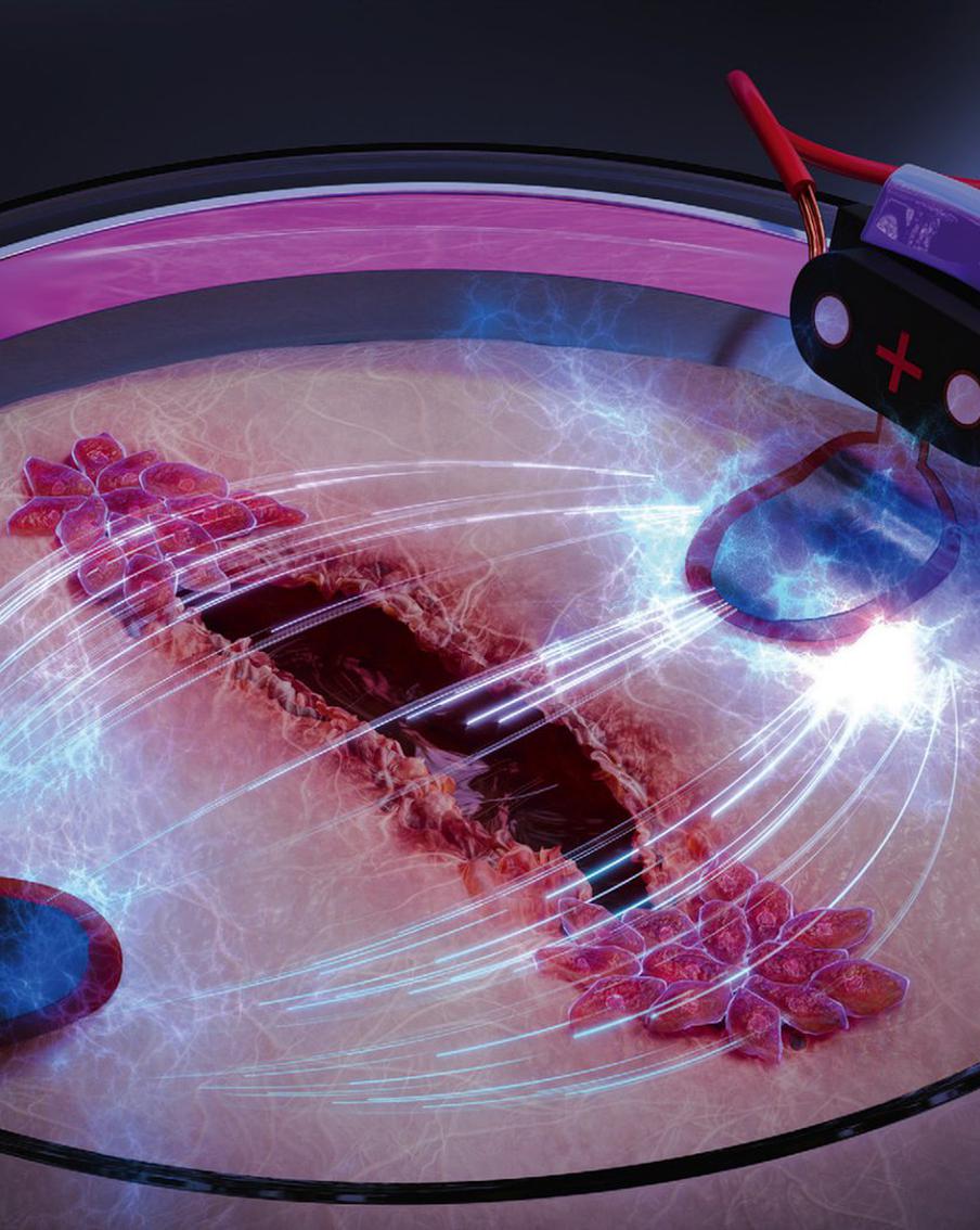 Раны, которые не затягиваются, очень опасны. Учёные нашли способ лечить их быстрее