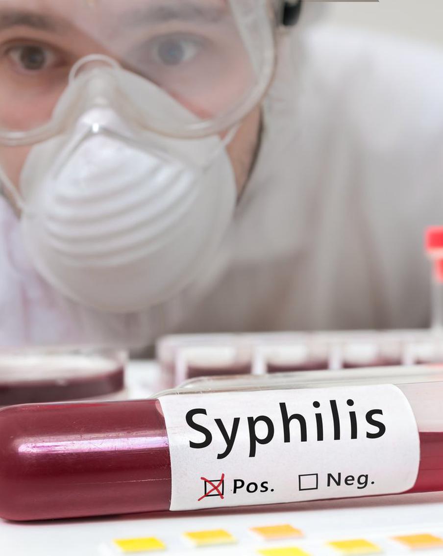 В Минздраве сообщили о причинах роста заражений сифилисом
