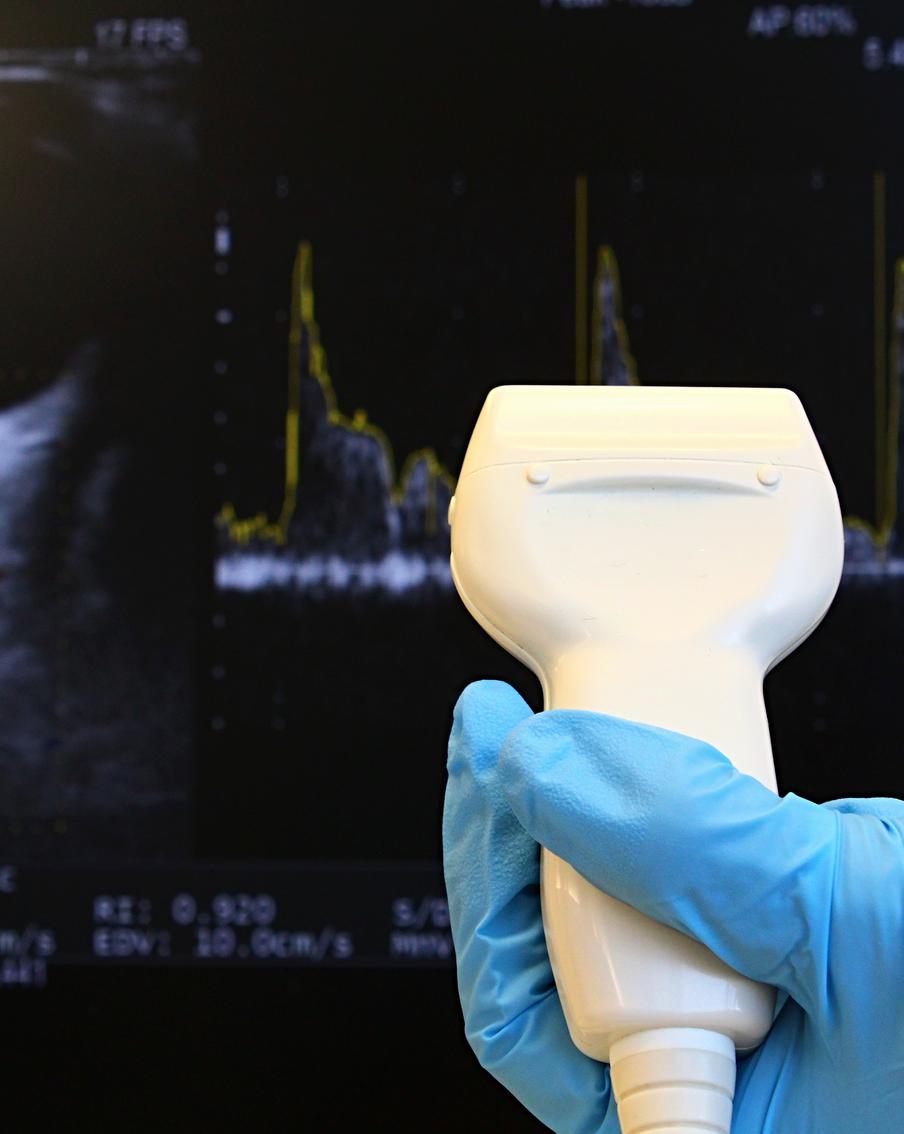 Опухоли будут лечить ультразвуком: в России стартовали исследования инновационного аппарата