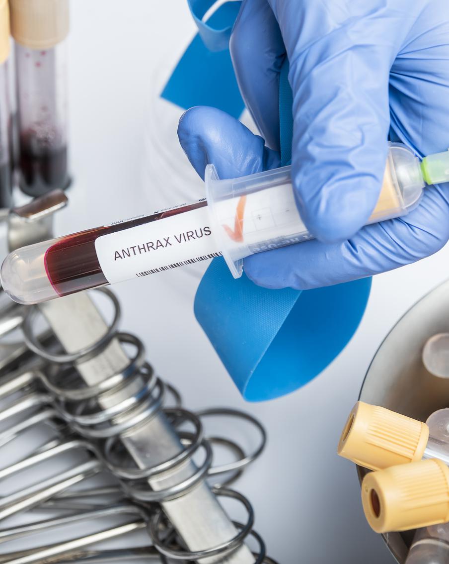 В Туве выявили новый случай заражения сибирской язвой