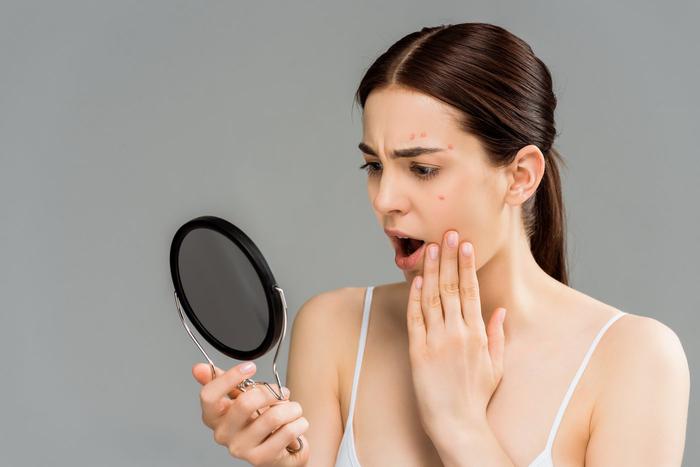 6 продуктов, вызывающих акне: от чего лучше отказаться на всю жизнь