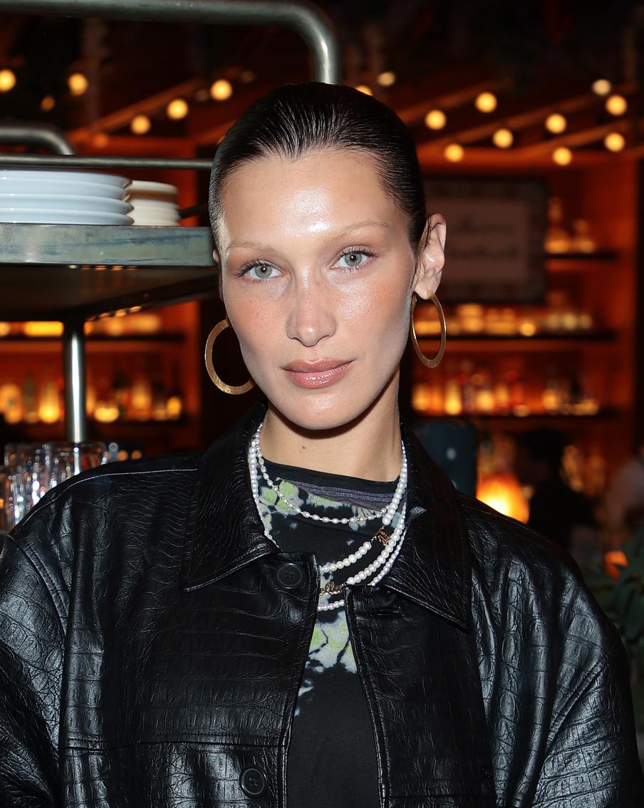 Самая красивая женщина в мире показала, как изменилась после болезни Лайма