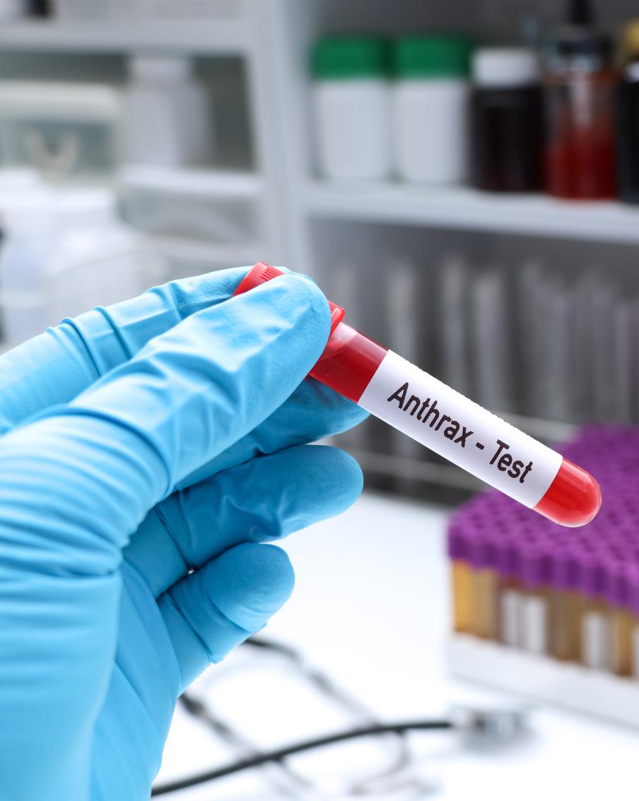 Под Воронежем обнаружили очаг сибирской язвы