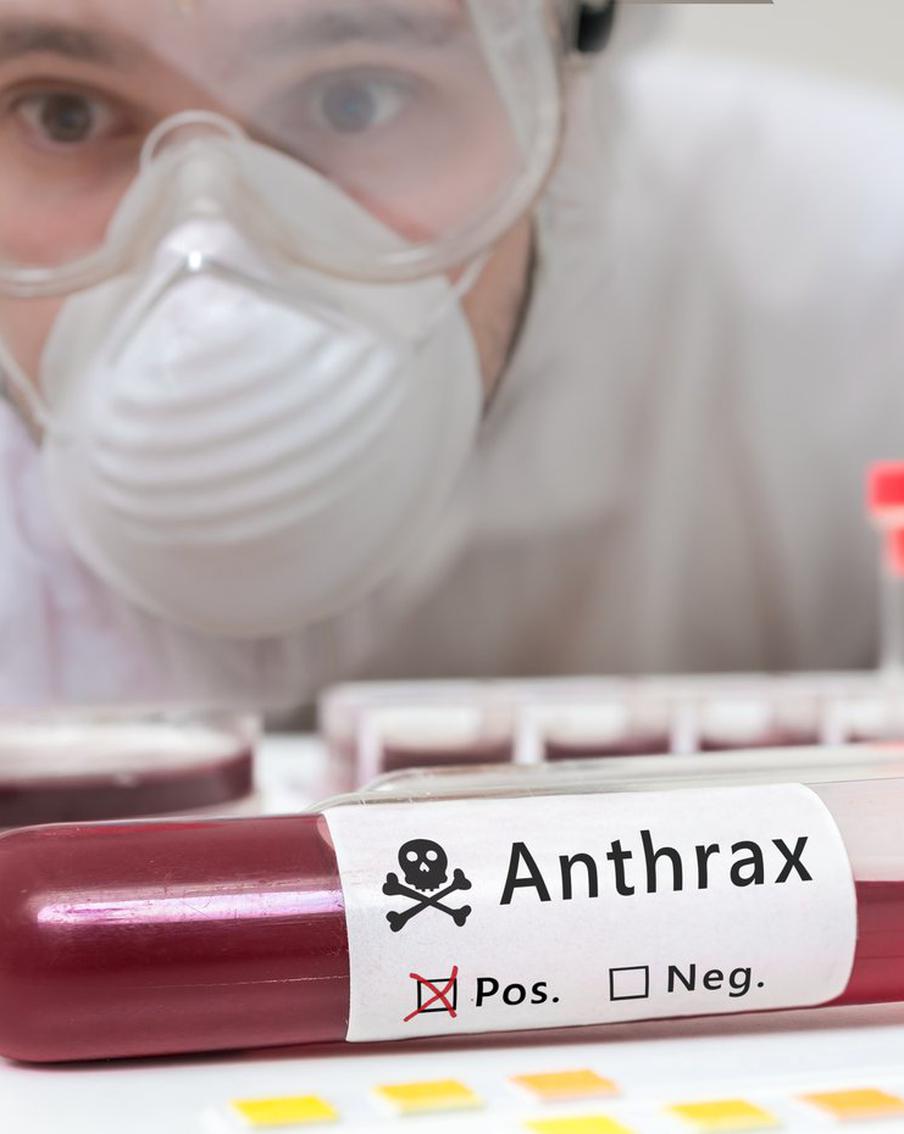 В Воронежской области зарегистрировали случай заражения сибирской язвой