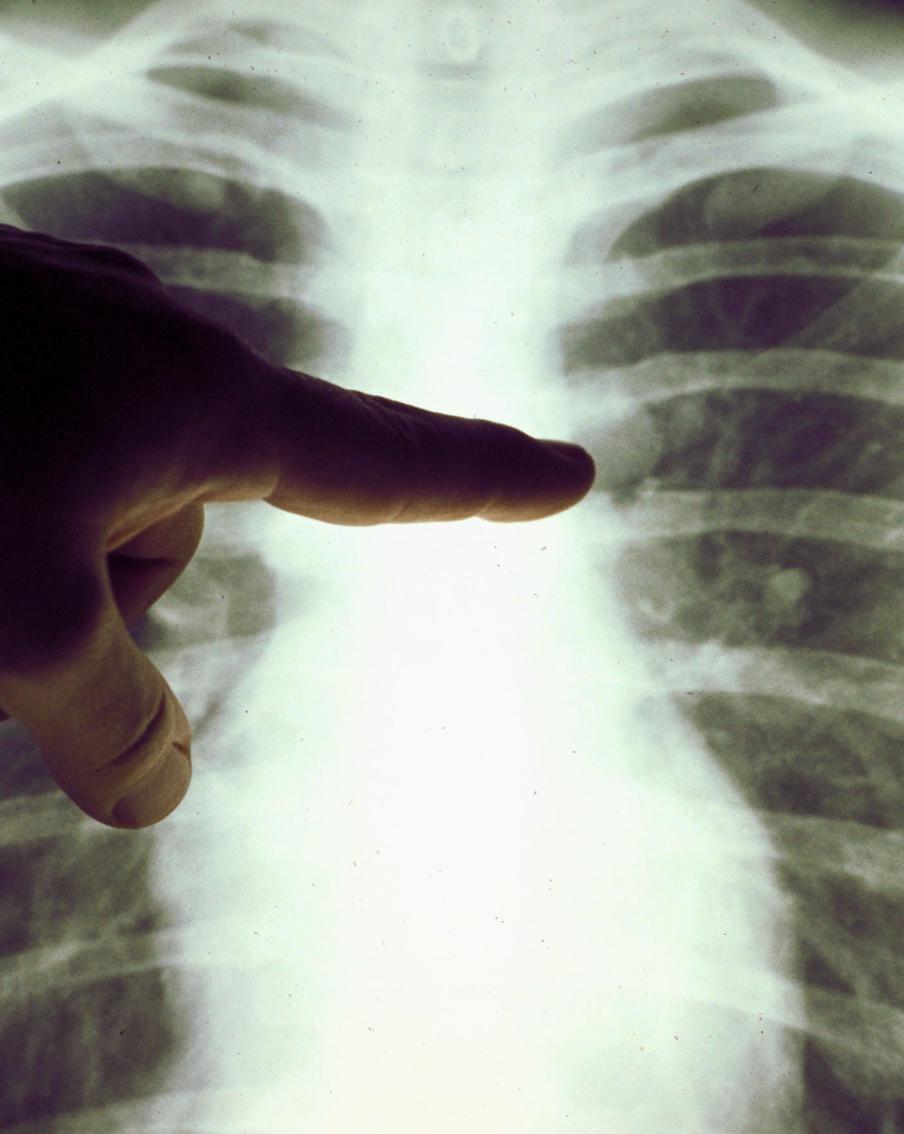 Китаянка закашлялась и сломала ребро