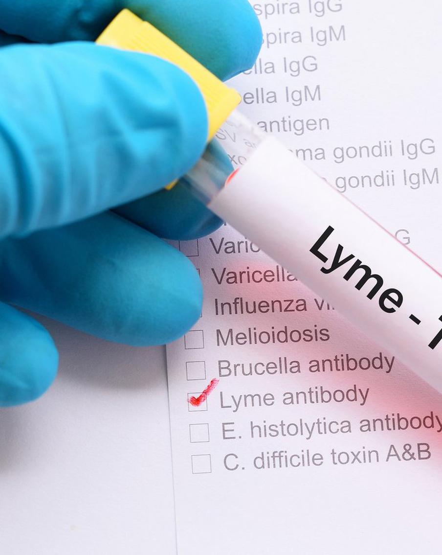 Учёные представили экспериментальную вакцину от боррелиоза. Как она работает?