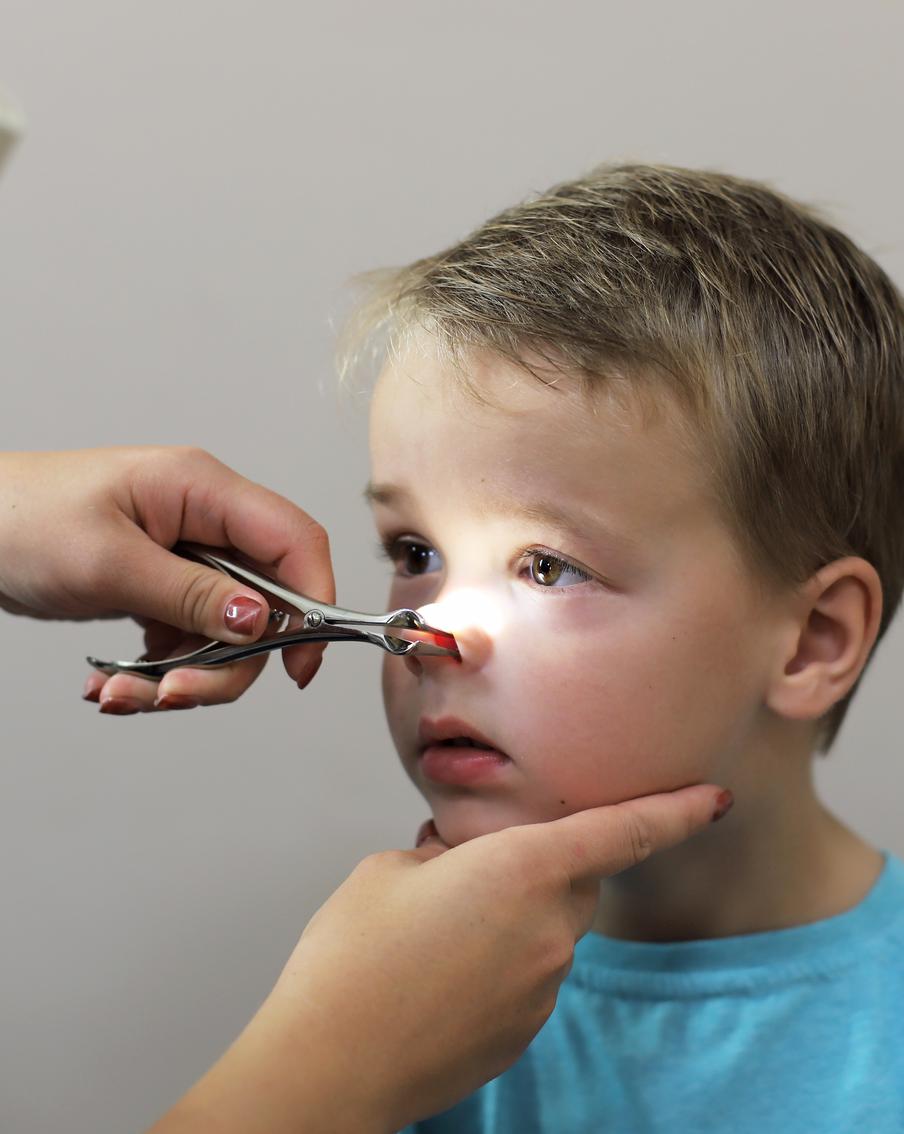 Что можно увидеть при помощи эндоскопа, если заглянуть глубоко в нос