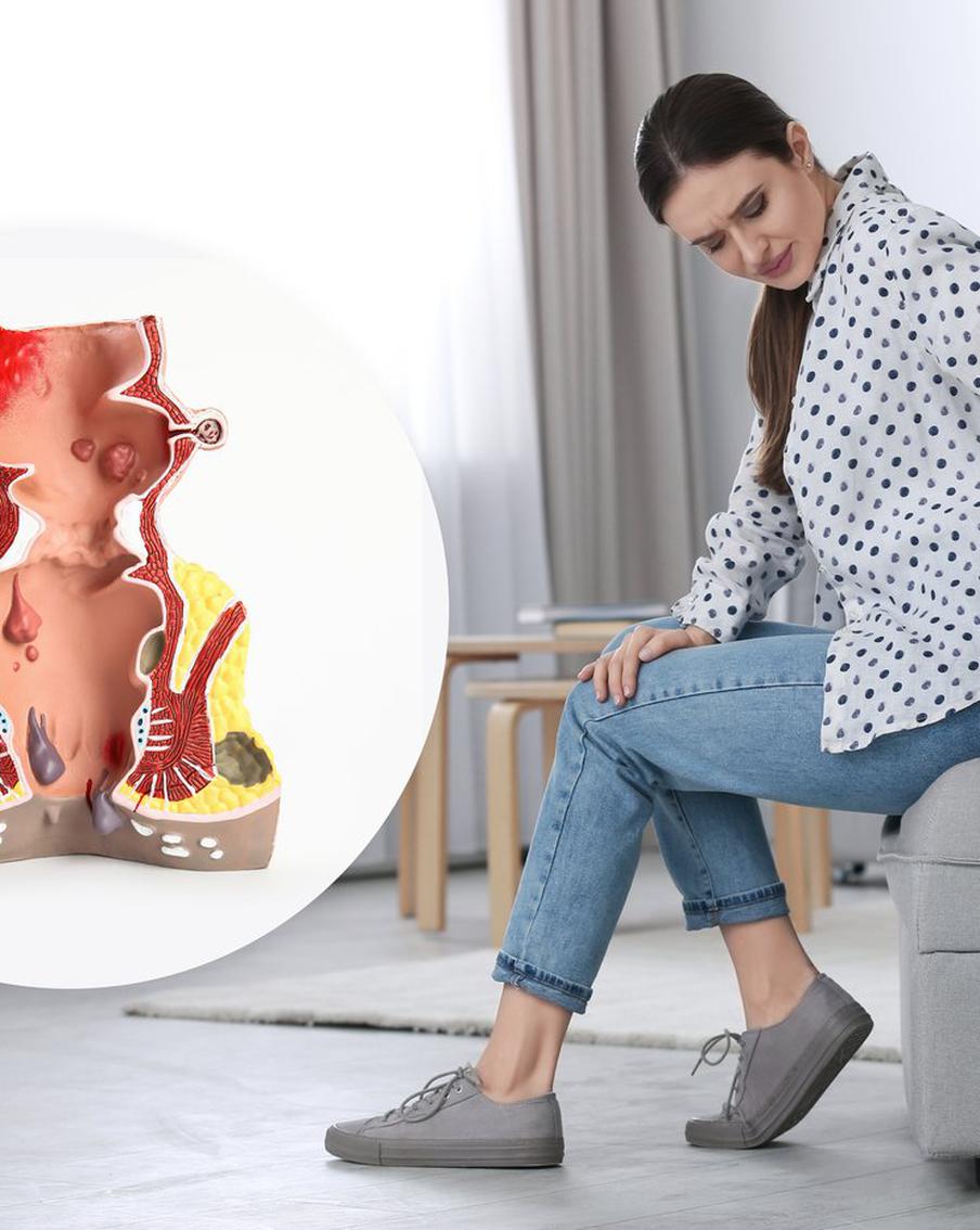 Поход к проктологу всегда вызывает страхи. Почему они беспочвенны?