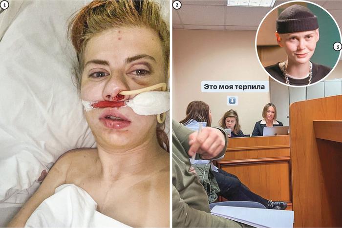 "Я не хочу, чтобы она дальше кого-то калечила": пострадавшая от Анны Тихой впервые дала интервью