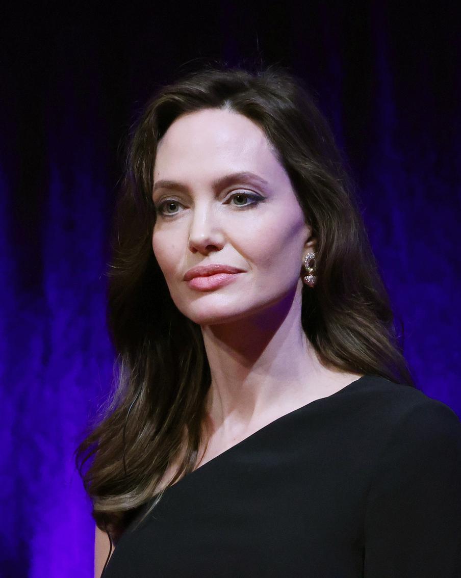 Анджелина Джоли рассказала, что у неё был паралич Белла