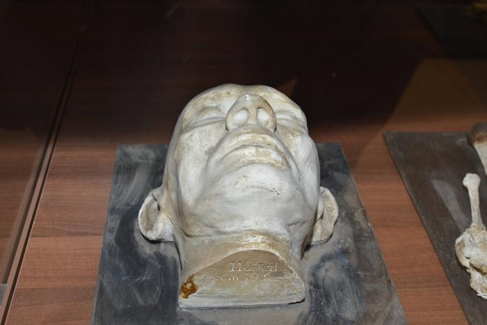 В Москве не хватает своей Кунсткамеры. Склиф показал человеческое нутро с патологиями