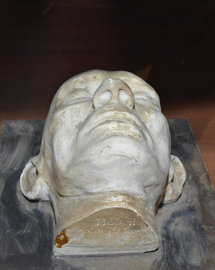 В Москве не хватает своей Кунсткамеры. Склиф показал человеческое нутро с патологиями