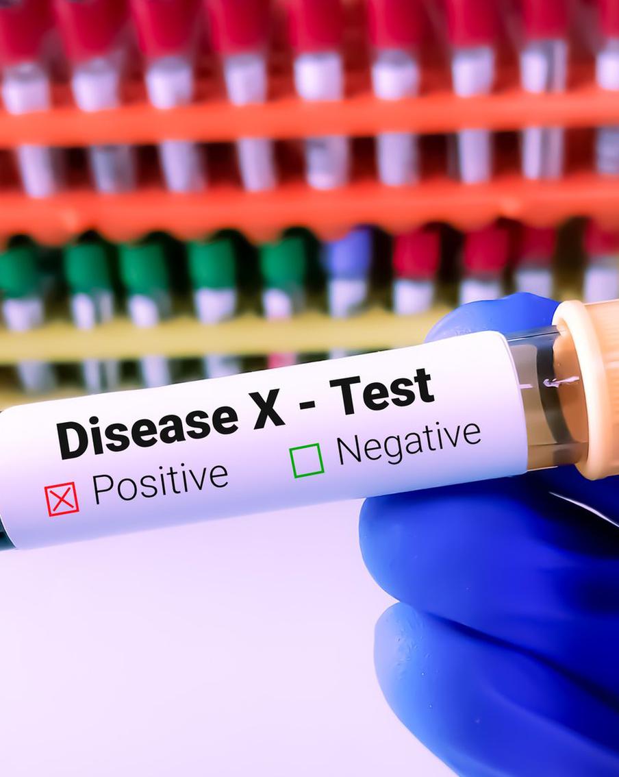 "Болезнь X": стоит ли бояться смоделированной угрозы человечеству? Спрашиваем у врача-иммунолога