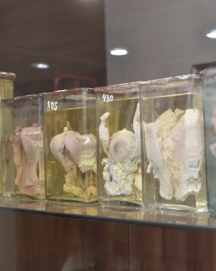 В профессиональный праздник патологоанатомов узнали, что они могут выяснить о человеке по телу