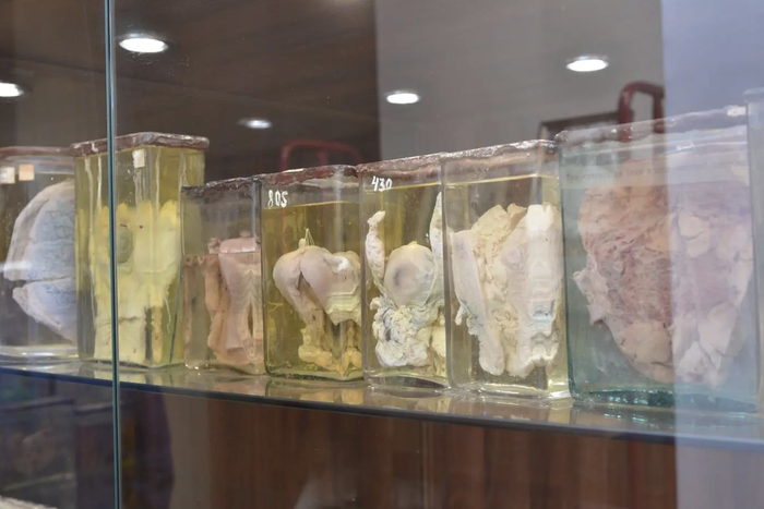 В профессиональный праздник патологоанатомов узнали, что они могут выяснить о человеке по телу