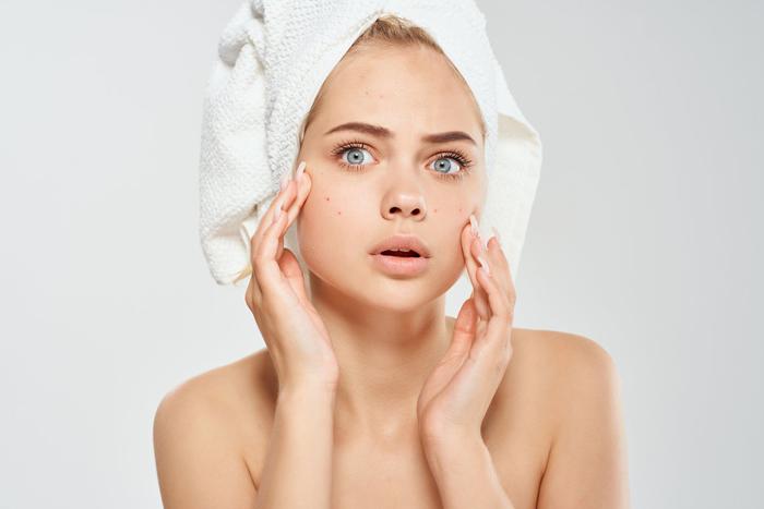 Масла, силиконы, ланолин и другие компоненты, которых нужно избегать при акне