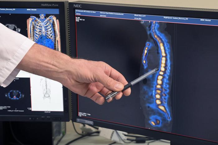 Время описания лучевых исследований сократилось в Москве в 16 раз