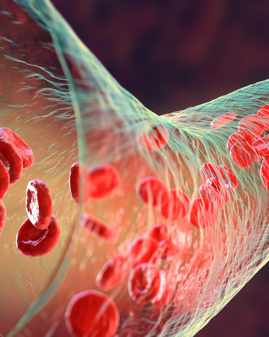 Уткин мог умереть из-за тромбоэмболии лёгочной артерии. Врач рассказал о тревожных симптомах