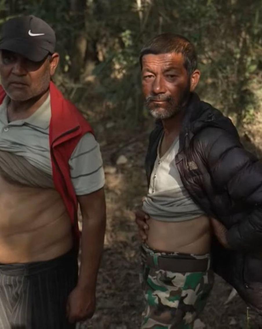 В "Долине почек" почти все живут с одной почкой