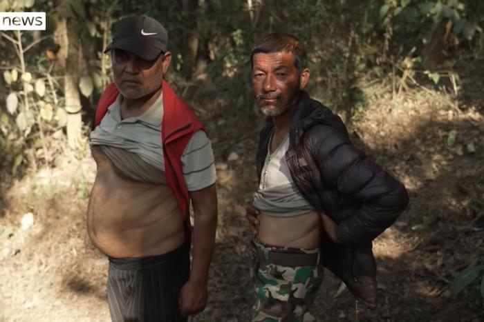 В "Долине почек" почти все живут с одной почкой