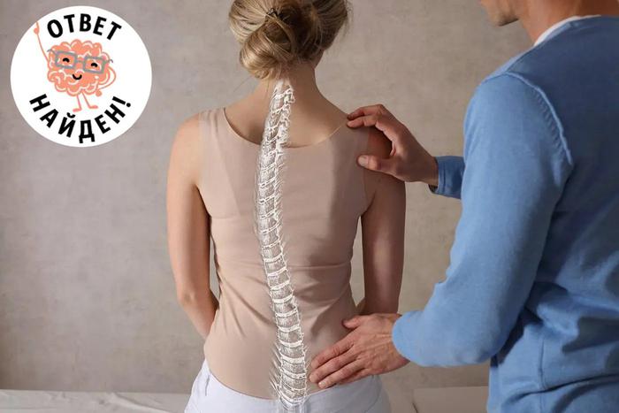 Сколиоз – это не только деформация позвоночника. Какие проблемы могут скрываться за этим диагнозом