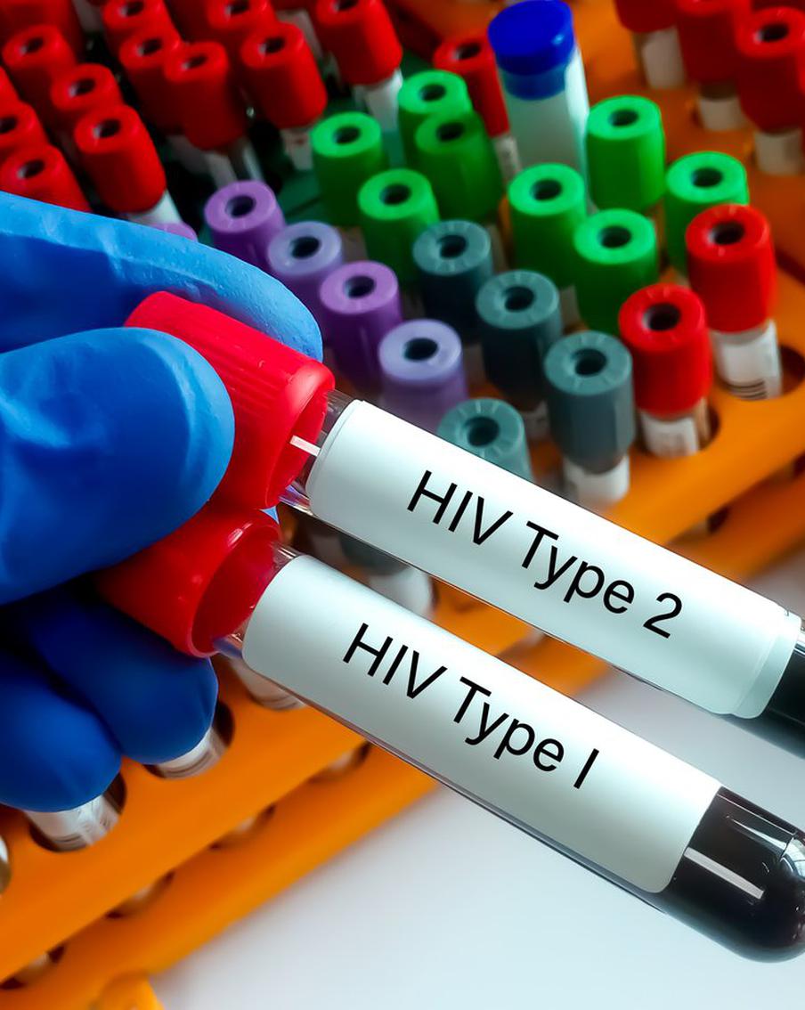 Международный день вакцины против ВИЧ: возможно, учёные совершили прорыв
