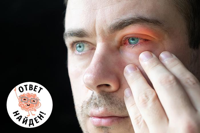 Как не стать кротом: почему конъюнктивит нужно лечить вовремя